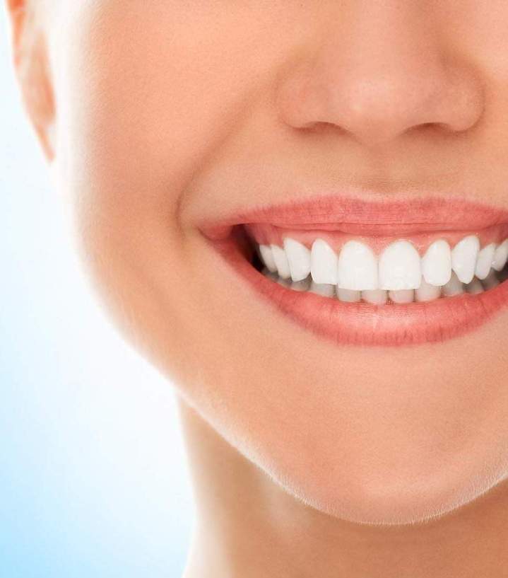 Sourire éclatant Rouen